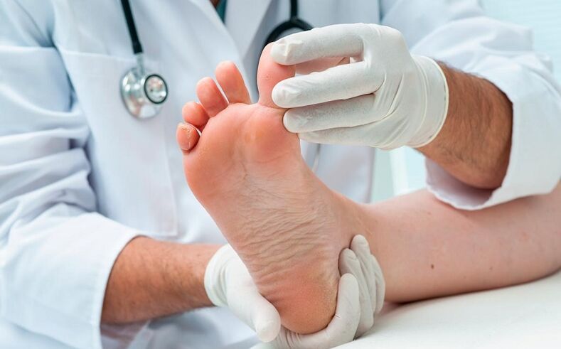 how and how to treat the fungus on the feet