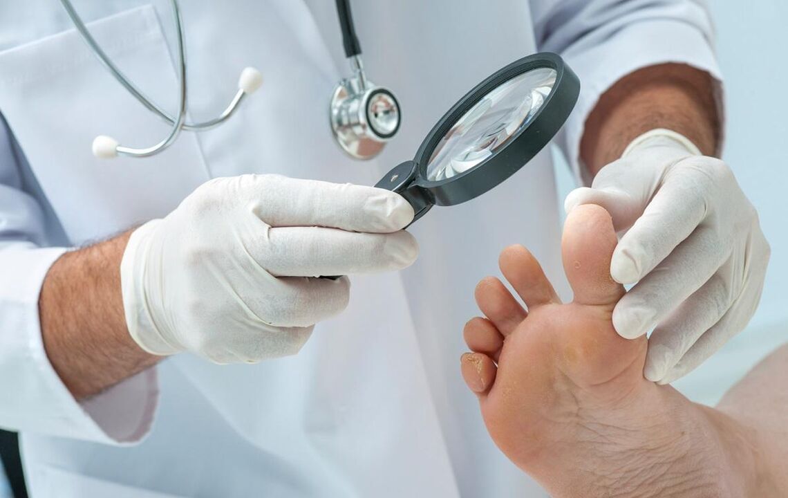 doctor examines feet with fungus
